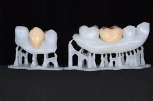 3d printed invisible-braces.